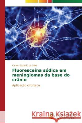 Fluoresceína sódica em meningiomas da base do crânio Da Silva Carlos Eduardo 9783639695922