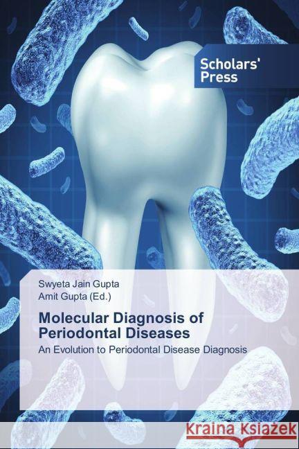 Molecular Diagnosis of Periodontal Diseases : An Evolution to Periodontal Disease Diagnosis Jain Gupta, Swyeta 9783639713435