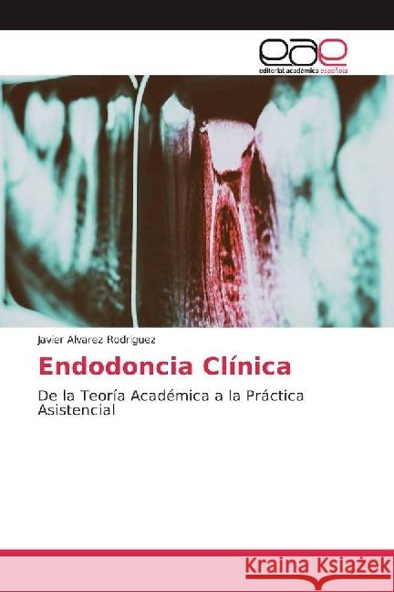 Endodoncia Clínica : De la Teoría Académica a la Práctica Asistencial Alvarez Rodriguez, Javier 9783639750324