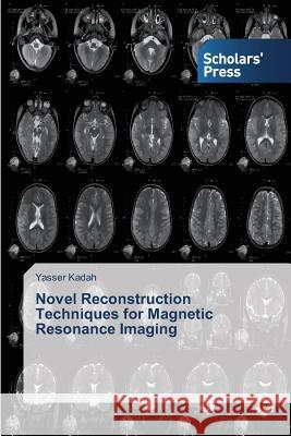 Novel Reconstruction Techniques for Magnetic Resonance Imaging Kadah Yasser 9783639761962