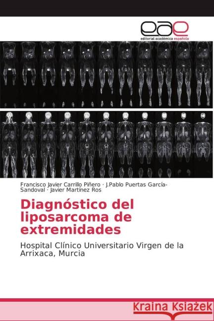 Diagnóstico del liposarcoma de extremidades : Hospital Clínico Universitario Virgen de la Arrixaca, Murcia Carrillo Piñero, Francisco Javier; Puertas García-Sandoval, J.Pablo; Martínez Ros, Javier 9783639784619