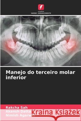 Manejo do terceiro molar inferior SAH, RAKCHA, DATTA, AKANSH, Agarwal, Nimish 9783639792607 Edições Nosso Conhecimento