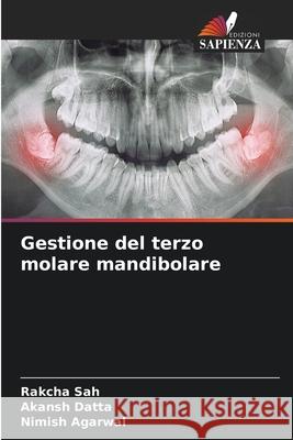 Gestione del terzo molare mandibolare SAH, RAKCHA, DATTA, AKANSH, Agarwal, Nimish 9783639793055 Edizioni Sapienza