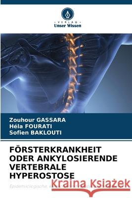 FÖRSTERKRANKHEIT ODER ANKYLOSIERENDE VERTEBRALE HYPEROSTOSE Gassara, Zouhour, Fourati, Hela, Baklouti, Sofien 9783639809794