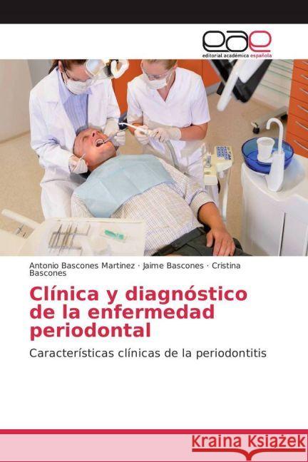 Clínica y diagnóstico de la enfermedad periodontal : Características clínicas de la periodontitis Bascones Martinez, Antonio; Bascones, Jaime; Bascones, Cristina 9783639875911