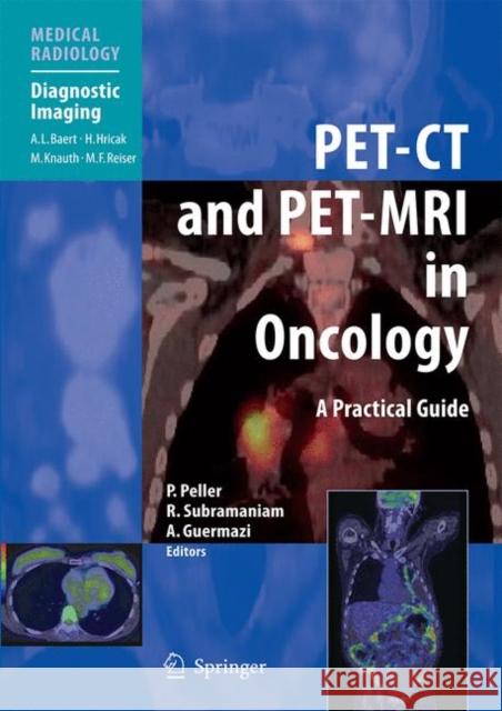 Pet-CT and Pet-MRI in Oncology: A Practical Guide Peller, Patrick 9783642011382