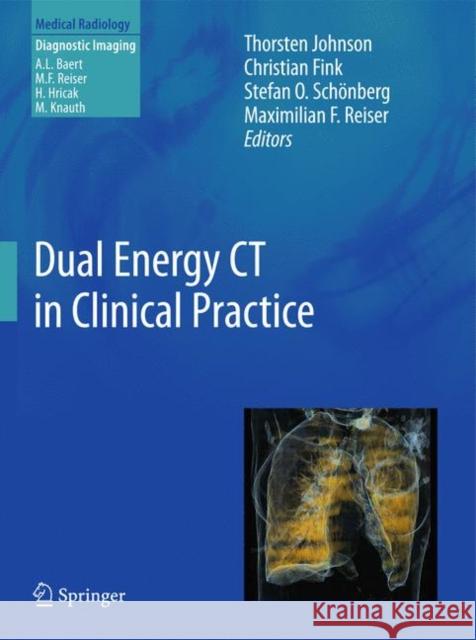 Dual Energy CT in Clinical Practice Thorsten Johnson Christian Fink Stefan O. Schonberg 9783642017391