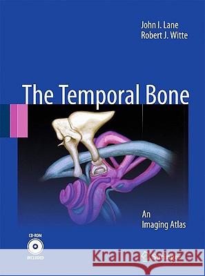 the temporal bone: an imaging atlas  Lane, John I. 9783642022098 Springer