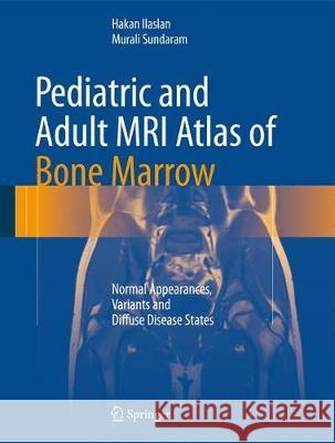 Pediatric and Adult MRI Atlas of Bone Marrow: Normal Appearances, Variants and Diffuse Disease States Ilaslan, Hakan 9783642027390 Not Avail