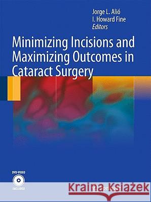 Minimizing Incisions and Maximizing Outcomes in Cataract Surgery [With DVD ROM] Alió Y. Sanz, Jorge L. 9783642028618