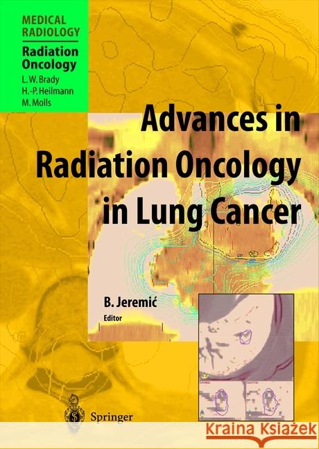 Advances in Radiation Oncology in Lung Cancer Branislav Jeremic L. W. Brady H. -P Heilmann 9783642056000 Not Avail