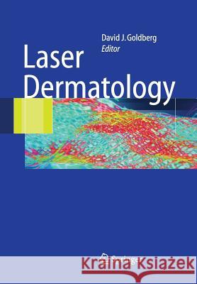 Laser Dermatology David J. Goldberg 9783642059582 Not Avail