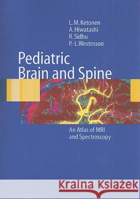 Pediatric Brain and Spine: An Atlas of MRI and Spectroscopy Ketonen, L. M. 9783642059698 Not Avail