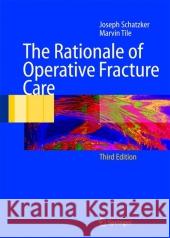 The Rationale of Operative Fracture Care Joseph Schatzker Marvin Tile T. S. Axelrod 9783642061646