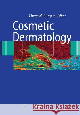 Cosmetic Dermatology Cheryl M. Burgess 9783642061998 Not Avail