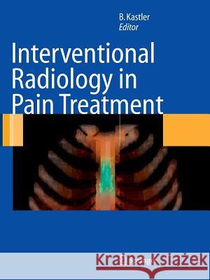 Interventional Radiology in Pain Treatment Bruno Kastler G. Salamon 9783642063947 Springer