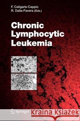 Chronic Lymphocytic Leukemia Federico Caligaris-Cappio 9783642064500 Not Avail