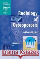 Radiology of Osteoporosis A.L. Baert, Stephan Grampp 9783642065262 Springer-Verlag Berlin and Heidelberg GmbH & 
