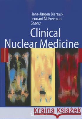 Clinical Nuclear Medicine Hans-Jurgen Biersack Leonard M. Freeman 9783642066313