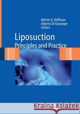 Liposuction: Principles and Practice Shiffman, Melvin a. 9783642066320 Not Avail