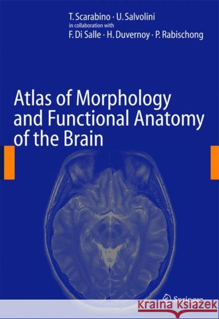 Atlas of Morphology and Functional Anatomy of the Brain T. Scarabino U. Salvolini 9783642067426