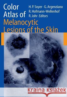 Color Atlas of Melanocytic Lesions of the Skin Hans Peter Soyer Giuseppe Argenziano Rainer Hofmann-Wellenhof 9783642071201 Springer