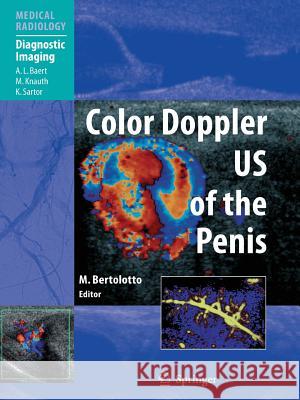 Color Doppler US of the Penis A.L. Baert, Michele Bertolotto 9783642071751 Springer-Verlag Berlin and Heidelberg GmbH & 