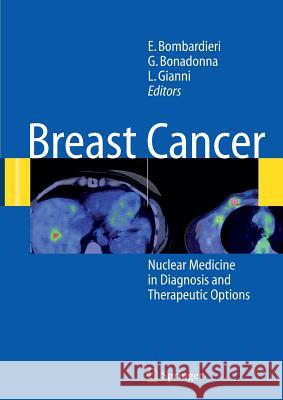 Breast Cancer: Nuclear Medicine in Diagnosis and Therapeutic Options Bombardieri, Emilio 9783642071867 Not Avail