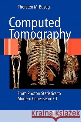 Computed Tomography: From Photon Statistics to Modern Cone-Beam CT Buzug, Thorsten M. 9783642072574