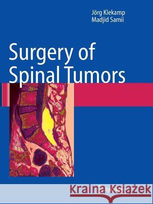Surgery of Spinal Tumors Jorg Klekamp Madjid Samii J. Rg Klekamp 9783642079481