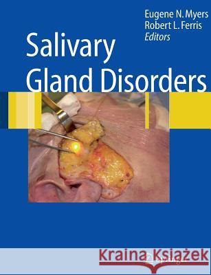 Salivary Gland Disorders Eugene N. Myers Robert L. Ferris 9783642079924 Not Avail