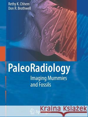 Paleoradiology: Imaging Mummies and Fossils R.K. Chhem, D.R. Brothwell 9783642080241