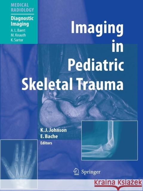 Imaging in Pediatric Skeletal Trauma: Techniques and Applications Johnson, Karl J. 9783642085451