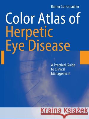 Color Atlas of Herpetic Eye Disease: A Practical Guide to Clinical Management Sundmacher, Rainer 9783642088995 Springer