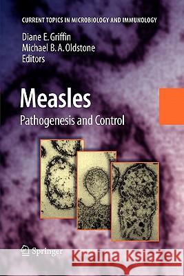 Measles: History and Basic Biology Diane E. Griffin, Michael B. A. Oldstone 9783642089442
