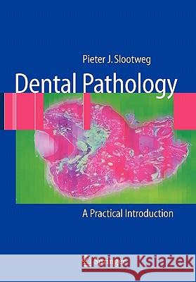 Dental Pathology: A Practical Introduction Slootweg, Pieter 9783642090813 Springer