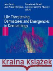 Life-Threatening Dermatoses and Emergencies in Dermatology  9783642098215 Springer, Berlin