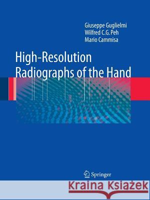 High-Resolution Radiographs of the Hand Giuseppe Guglielmi Wilfred C. G. Peh Mario Cammisa 9783642098413 Not Avail
