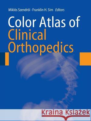 Color Atlas of Clinical Orthopedics Miklos Szendroi Franklin Sim 9783642099199 Springer