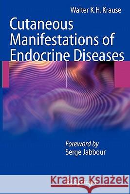 Cutaneous Manifestations of Endocrine Diseases Krause, Walter K. H. 9783642100024 Springer