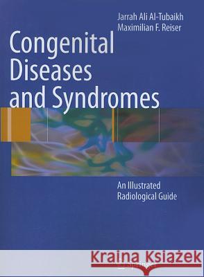 Congenital Diseases and Syndromes: An Illustrated Radiological Guide Al-Tubaikh, Jarrah Ali 9783642101199 Springer-Verlag Berlin and Heidelberg GmbH & 