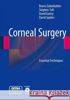 Corneal Surgery: Essential Techniques Zuberbuhler, Bruno 9783642125010
