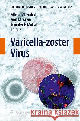 Varicella-Zoster Virus Abendroth, Allison 9783642127274 Not Avail