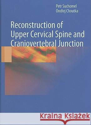 Reconstruction of Upper Cervical Spine and Craniovertebral Junction Petr Suchomel Ondrej Choutka 9783642131578 Not Avail