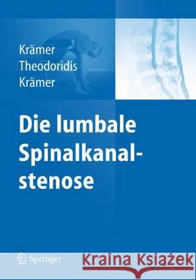 Die Lumbale Spinalkanalstenose Krämer, Robert 9783642138423 Not Avail