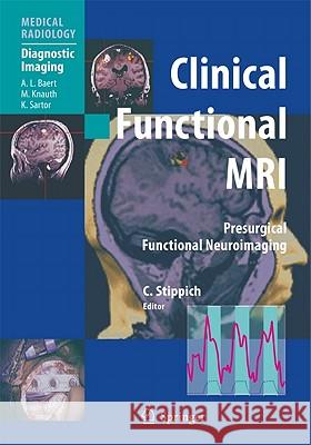 Clinical Functional MRI: Presurgical Functional Neuroimaging Sartor, K. 9783642140051