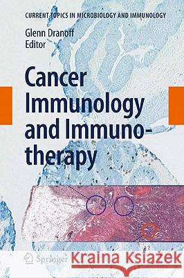 Cancer Immunology and Immunotherapy Glenn Dranoff 9783642141355 Springer-Verlag Berlin and Heidelberg GmbH & 