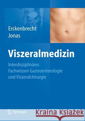 Viszeralmedizin: Interdisziplinäres Facharztwissen Gastroenterologie Und Viszeralchirurgie Erckenbrecht, J. F. 9783642143007 