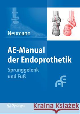 Ae-Manual Der Endoprothetik: Sprunggelenk Und Fuß Neumann, Hans Wolfram 9783642148859