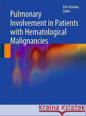 Pulmonary Involvement in Patients with Hematological Malignancies Elie Azoulay 9783642157417 Not Avail